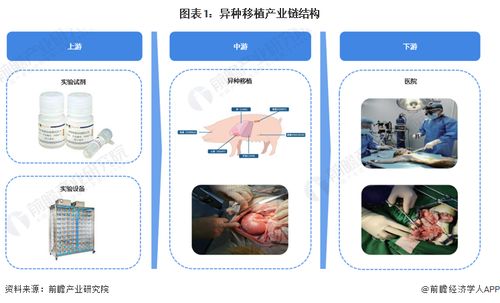 重大里程碑 科學(xué)家首次將豬肝移植到人體，成功過濾血液72小時(shí)，計(jì)算機(jī)軟硬件技術(shù)開發(fā)的關(guān)鍵作用